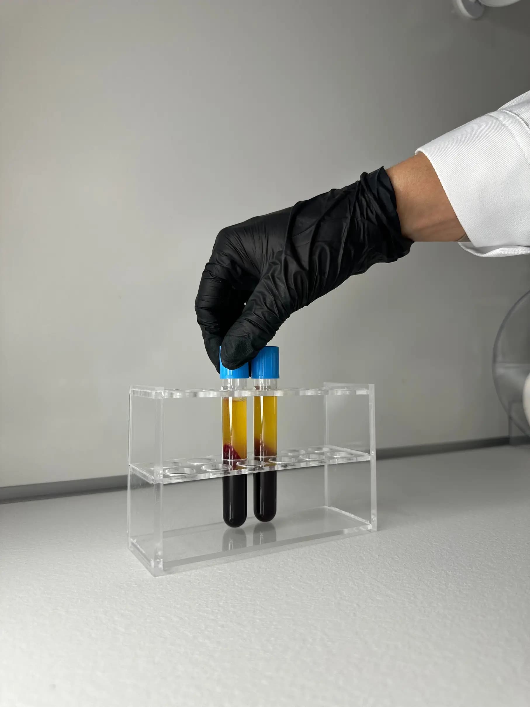 PRF Eigenbluttherapie